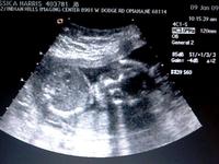 Elaine's Ultrasound