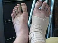 Feet, Compared