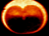 Magnetic resonance imaging (MRI) of cell division.