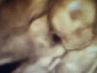 Gender Scan
