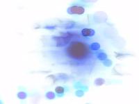citoplasma