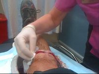 MattPatt's knee wound