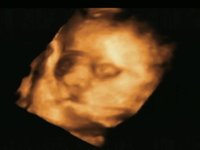 Lili-Anne 2009-09-05