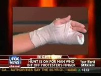 Health Care: Has Obama bitten off more than he can chew?