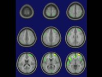 Your Brain on Sex