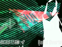 SOURCE Visuals: MICROTECH.2 by Rebel Overlay (demo)