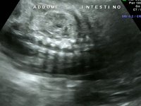 Visualizza