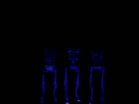 Dancing Skeletons