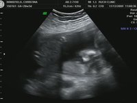 20 week ultrasound (part 1)