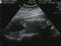 20 week ultrasound (part 2)