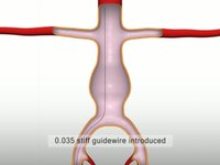 Anaconda Animation