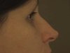 Upstate New York Videographers