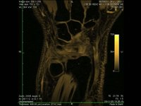 Wrist MRI Sequence