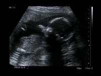 our baby