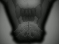Darko
