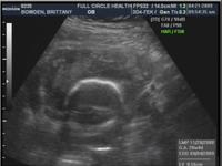 Baby B workin it out in la belly